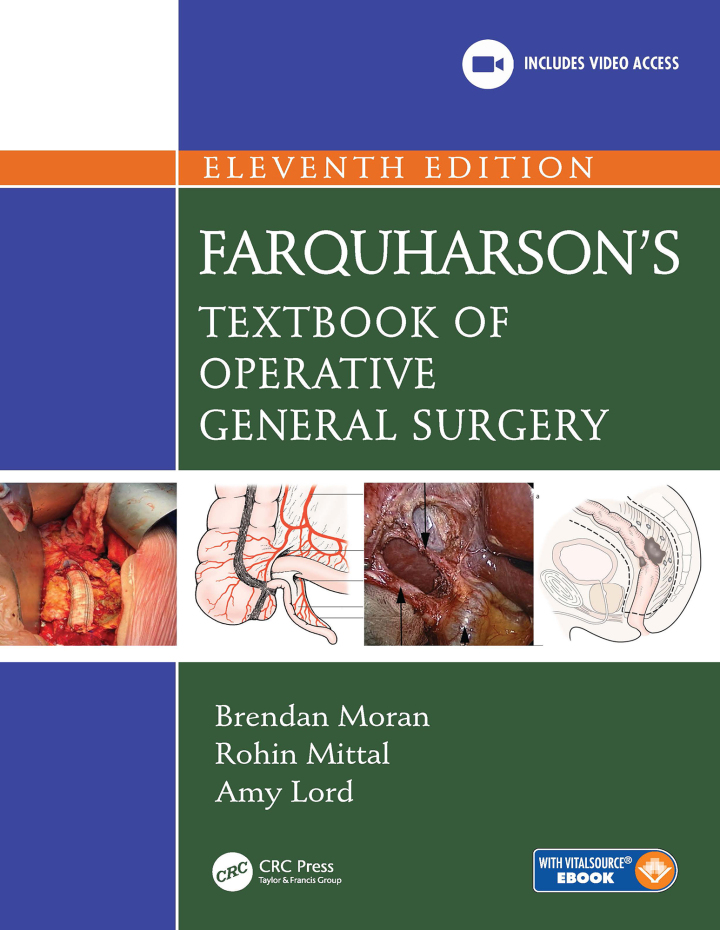 Farquharson's Textbook of Operative General Surgery 11th Edition
