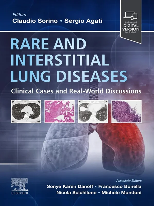 Rare and Interstitial Lung Diseases: Clinical Cases and Real-World Discussions