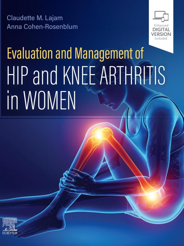 Evaluation and Management of Hip and Knee Arthritis in Women